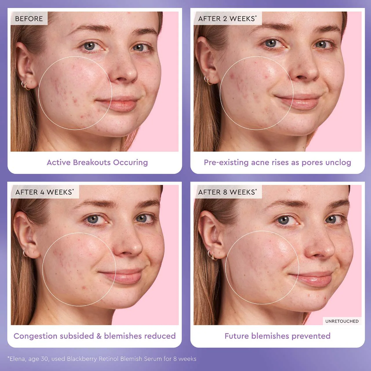 Glow Recipe Blackberry Retinol Blemish Serum 4