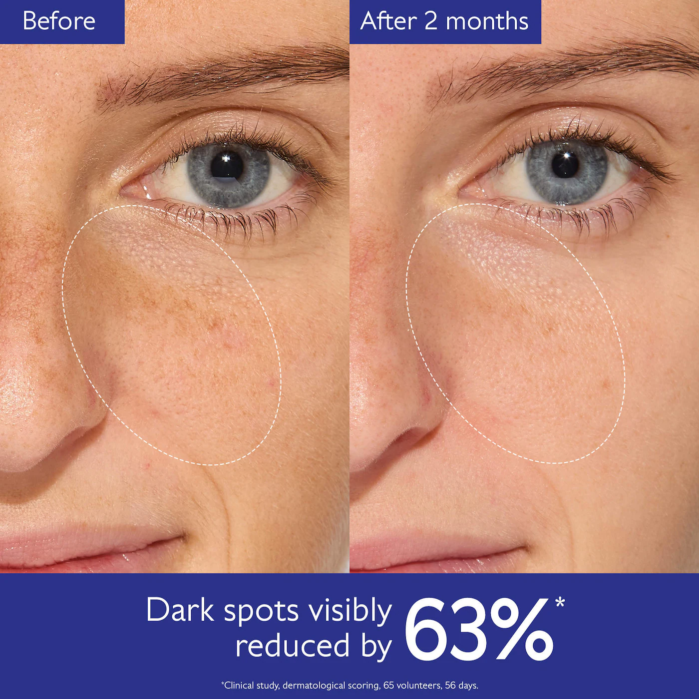 Caudalie  Vinoperfect Brightening Set for Dark Spots and Uneven Skin Tone 4