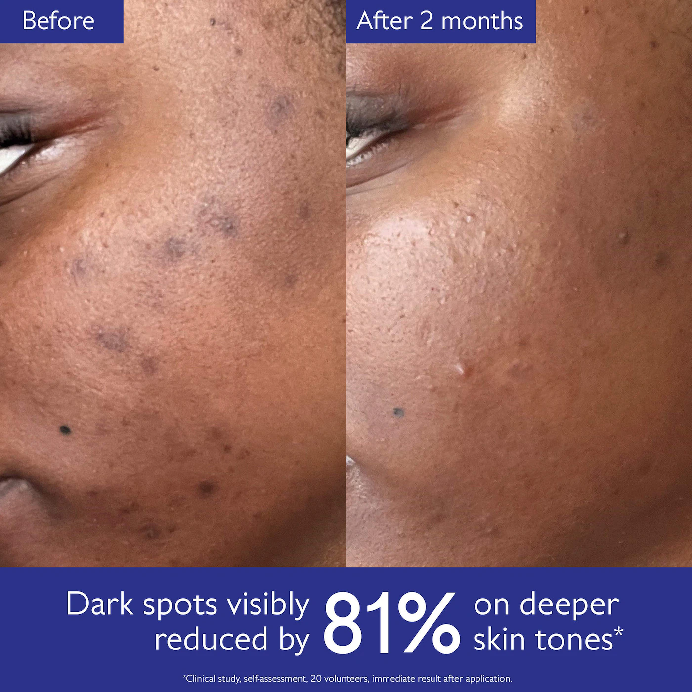 Caudalie  Vinoperfect Brightening Set for Dark Spots and Uneven Skin Tone 3