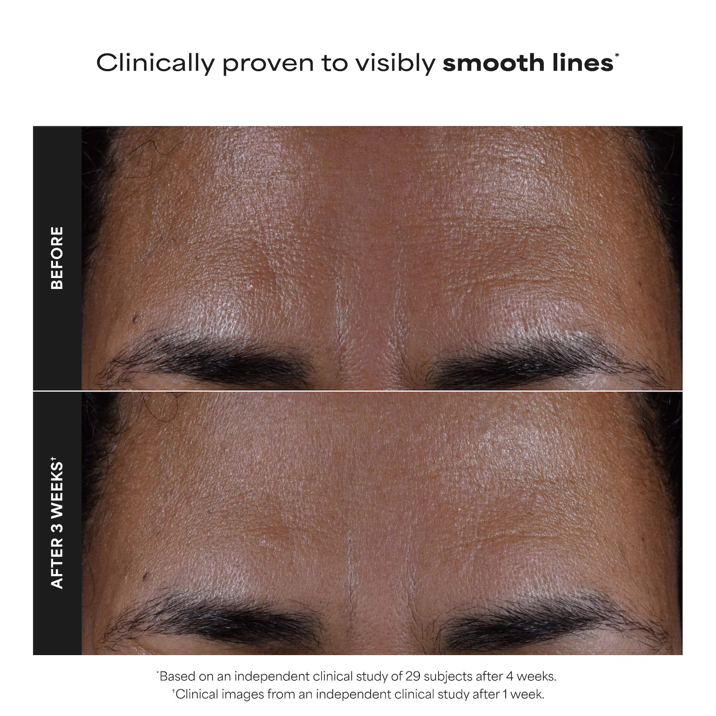 Paula's Choice  Skin Perfecting 2% BHA Exfoliating Toner for Clear Skin 4