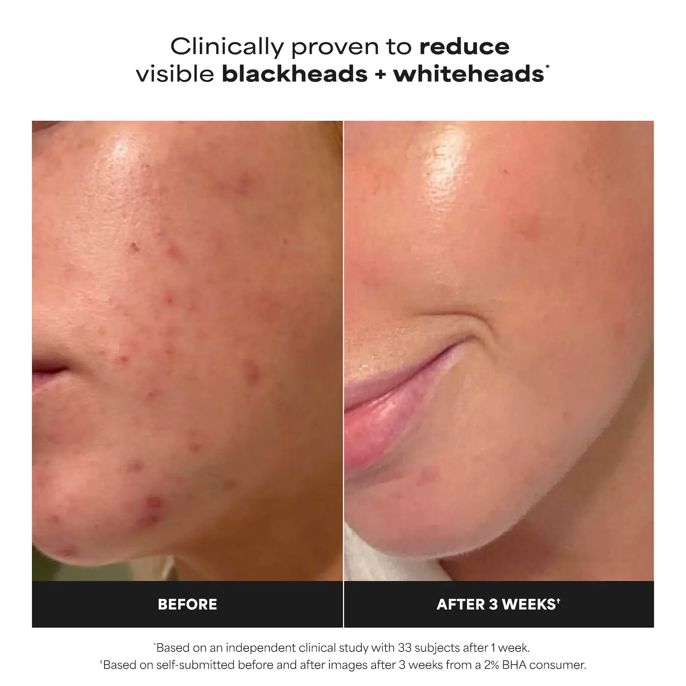 Paula's Choice  Skin Perfecting 2% BHA Exfoliating Toner for Clear Skin 3