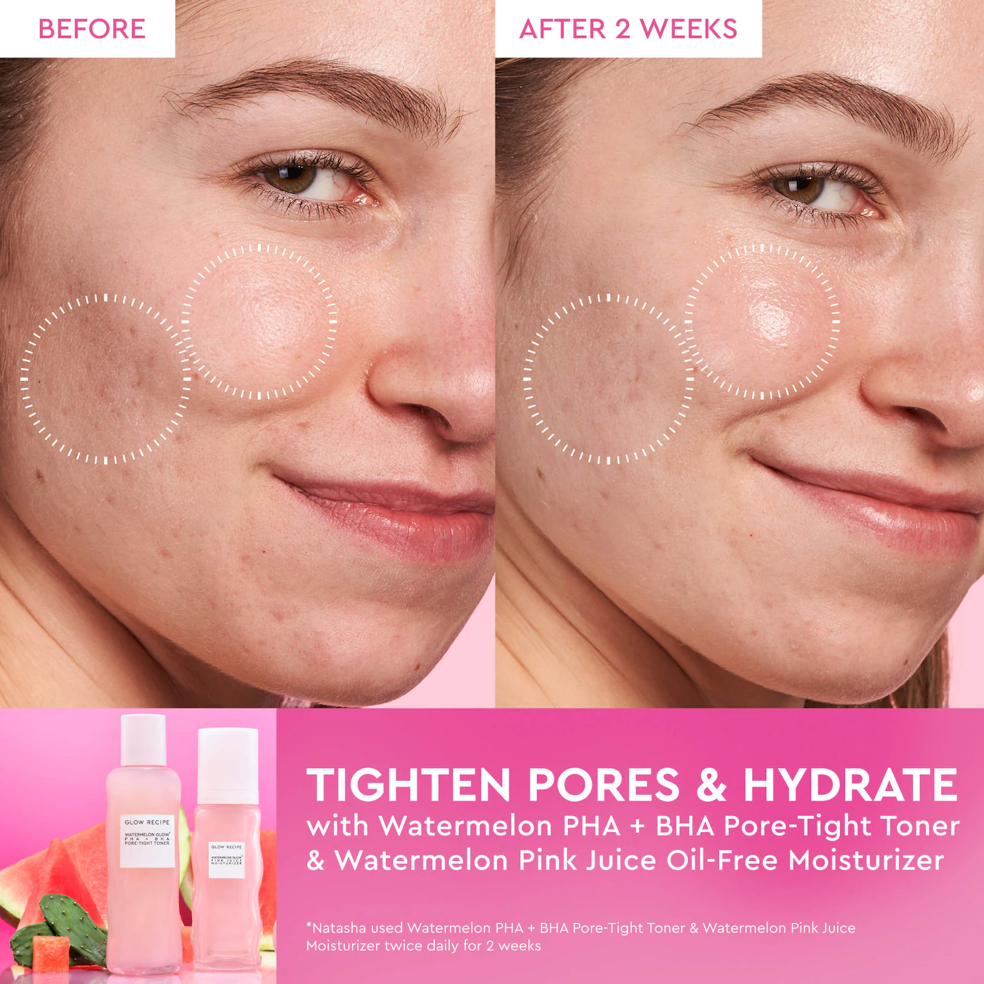 Glow Recipe  Watermelon Glow PHA + BHA Pore-Tight Toner 3