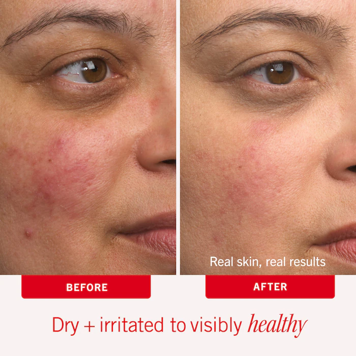 First Aid Beauty  Ultra Repair® Cream Intense Hydration – Face and Body Moisturizer for Skin Repair 3
